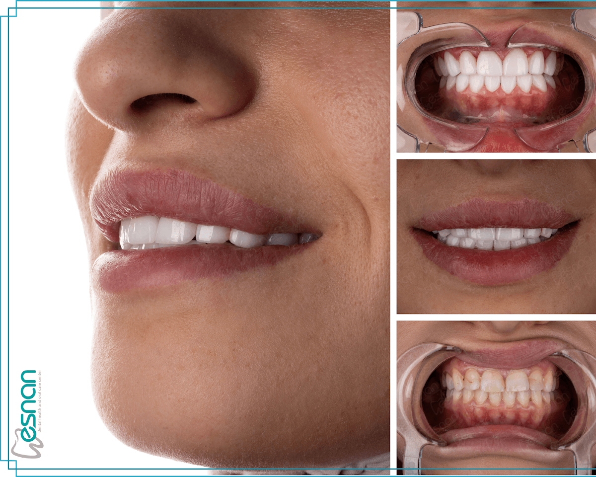 Esnan Dental Clinics in Turkey - Skyland