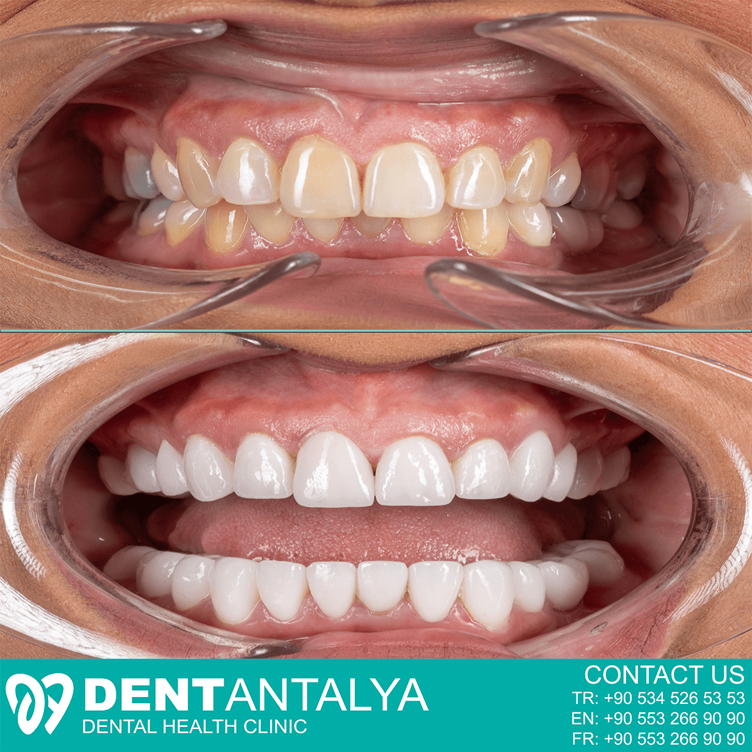 DentAntalya (Oral & Dental Health Clinic)