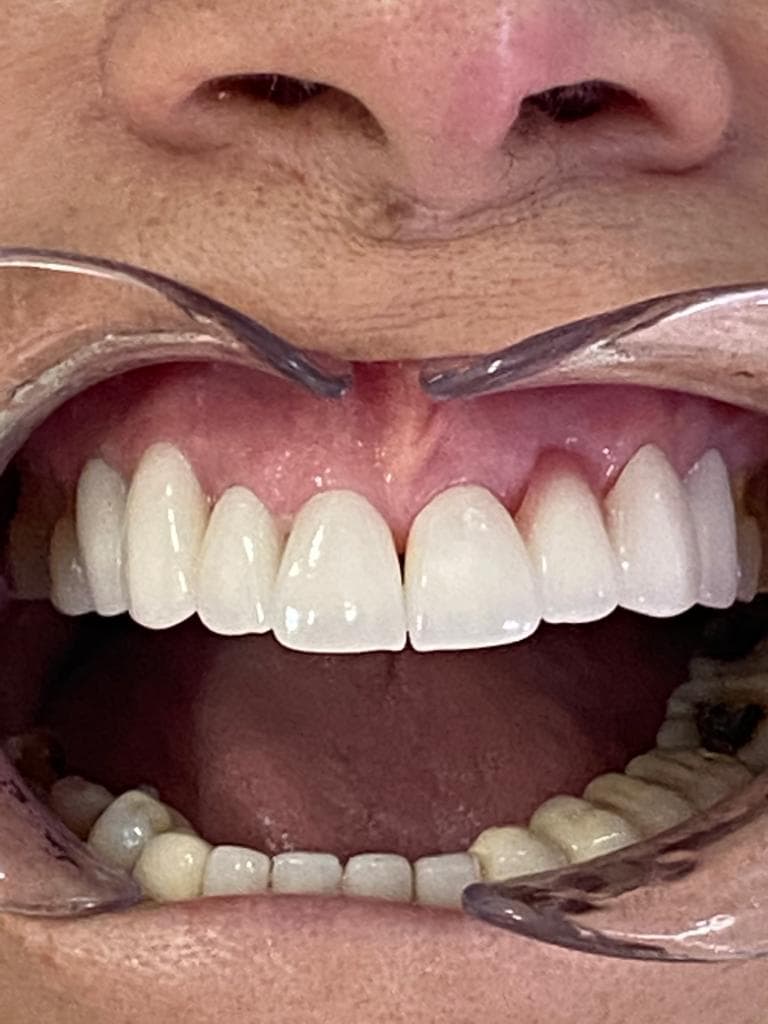 DentAntalya (Oral & Dental Health Clinic)