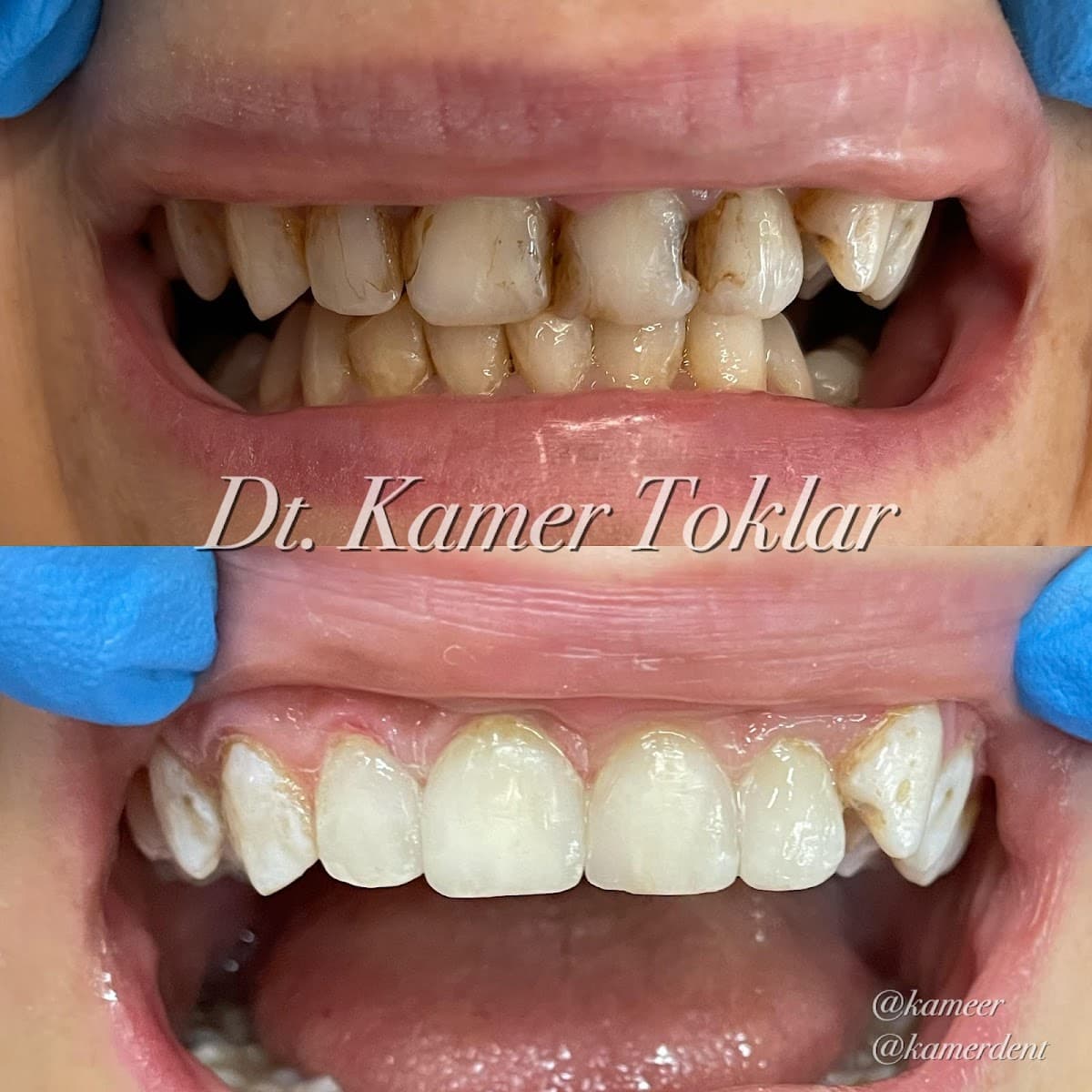 BAŞAKŞEHİR KAMERDENT AĞIZ VE DİŞ SAĞLIĞI POLİKLİNİĞİ