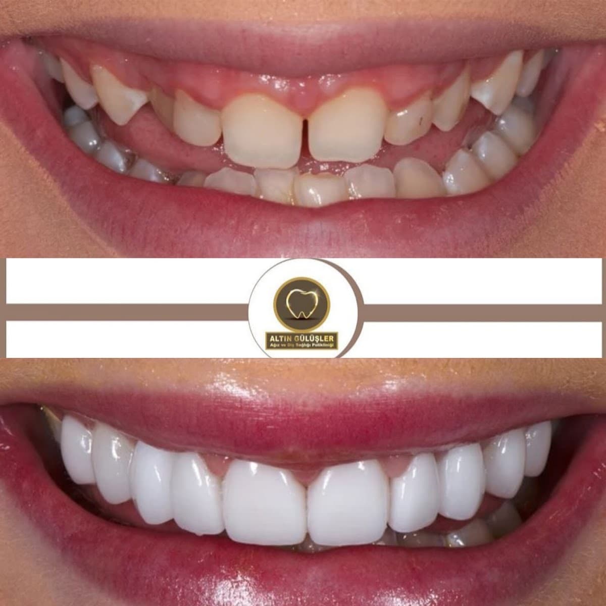 Golden Smile Basaksehir