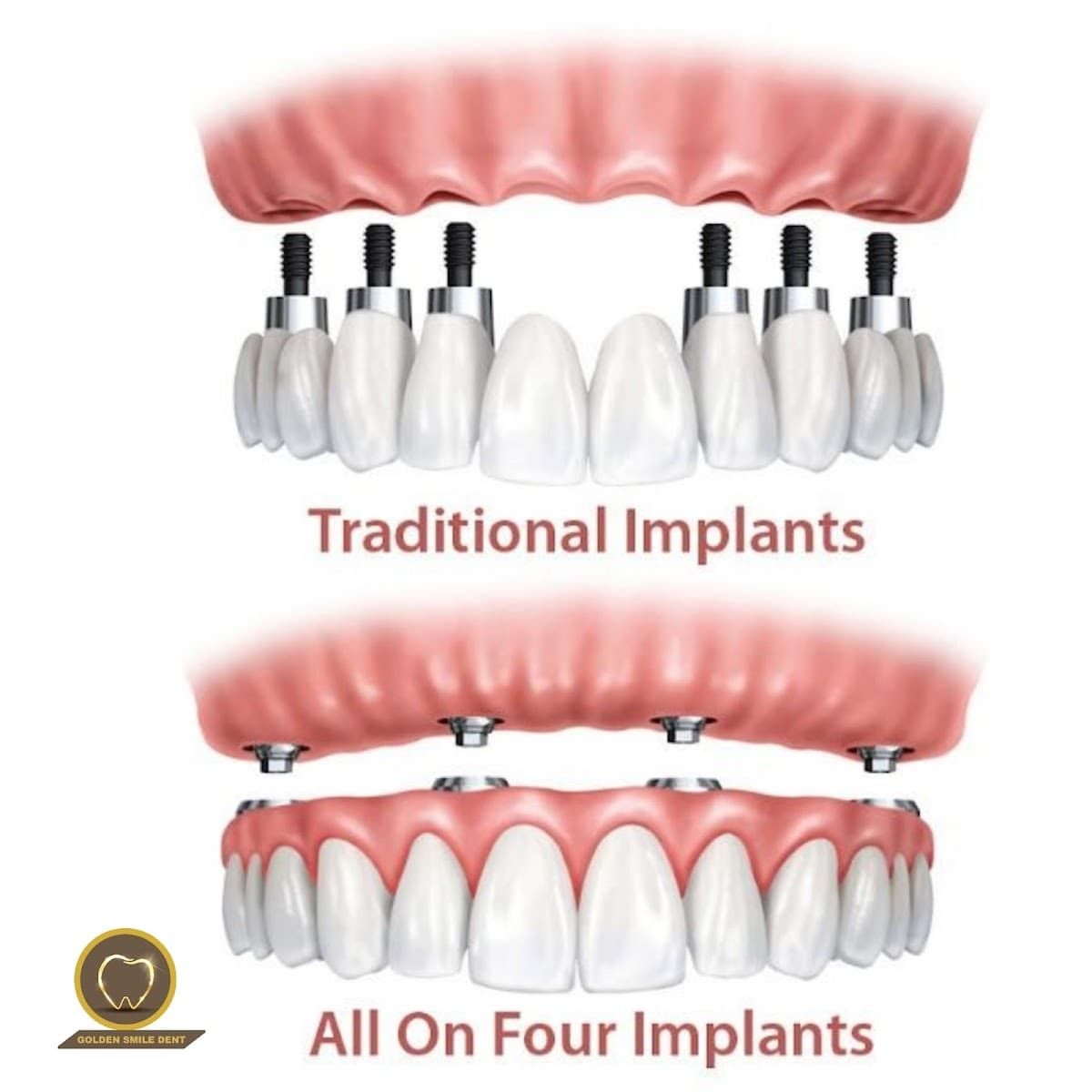 Golden Smile Basaksehir