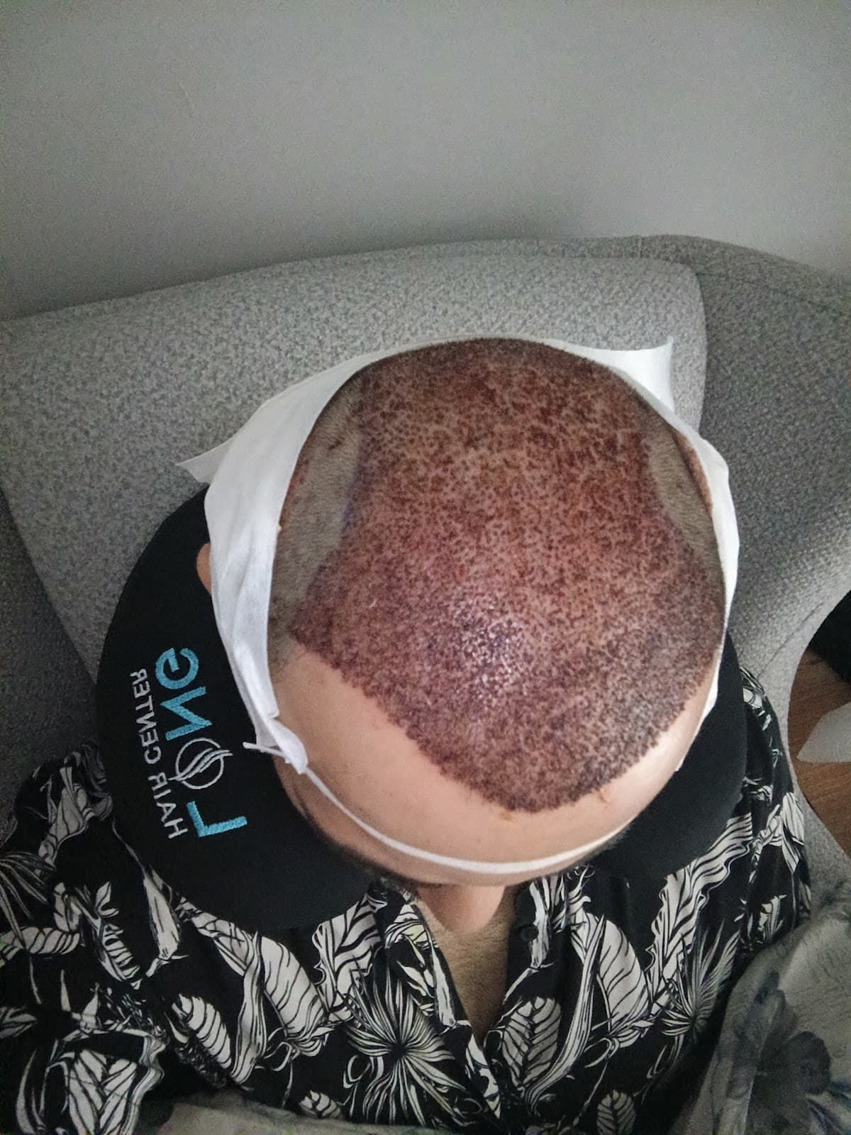 Long Hair Center Istanbul (LHC CLINIC)