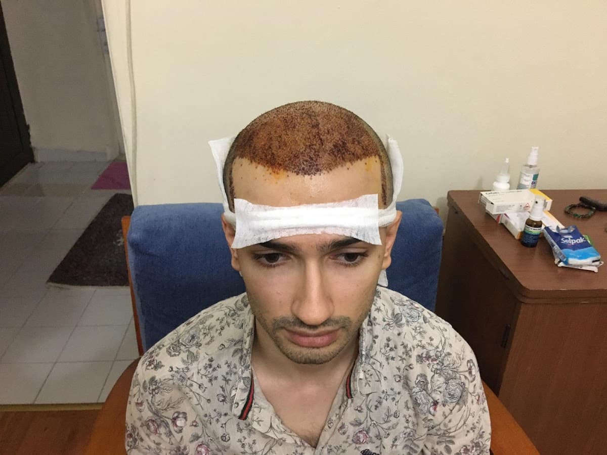 Forest Klinik | Estetik & Saç Ekimi