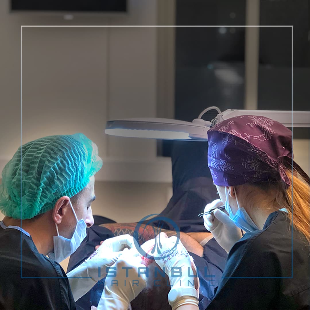 Istanbul Hair Clinic