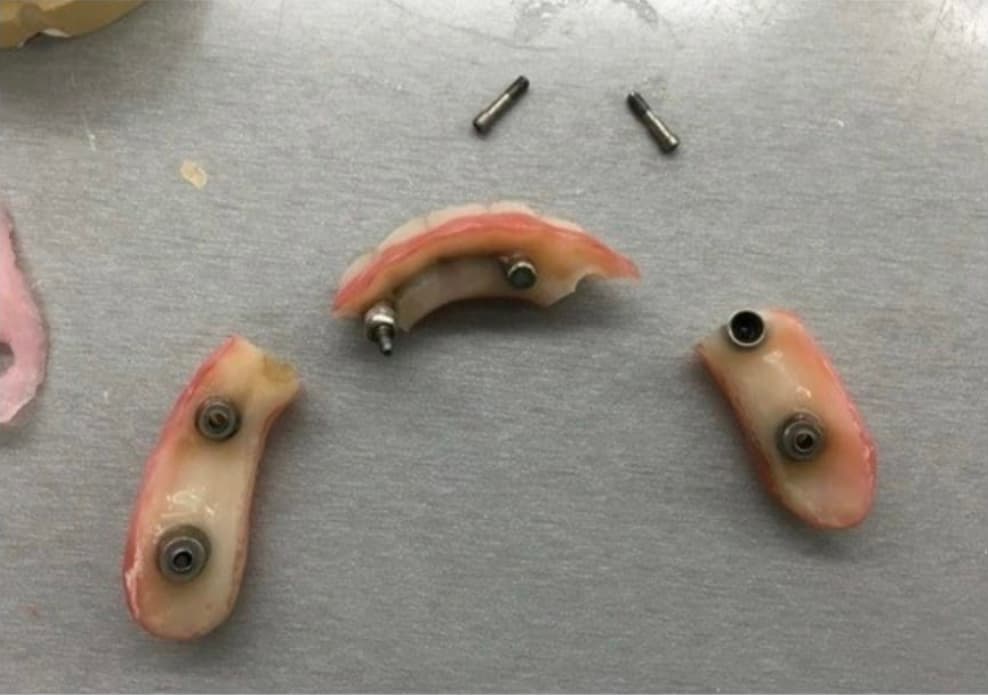 All On Dental Clinic Istanbul