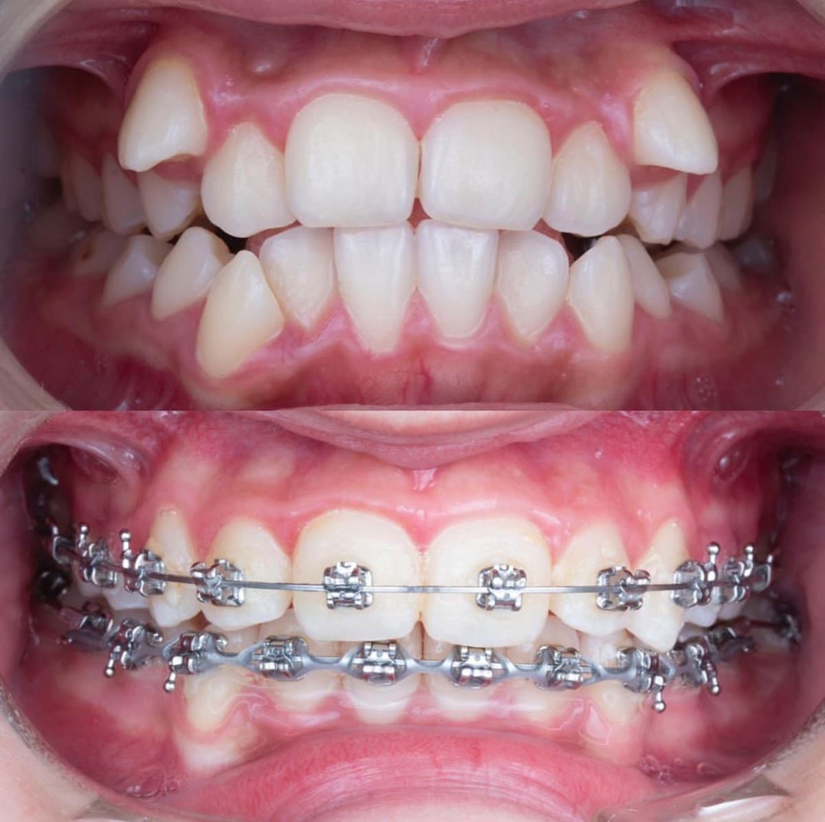 KLİNİK ANKARA AĞIZ VE DİŞ SAĞLIĞI POLİKLİNİĞİ