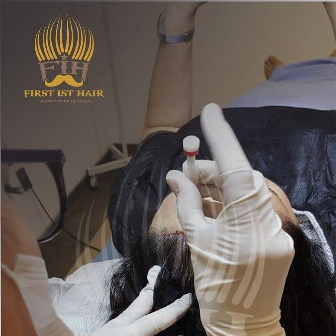 First İst Hair