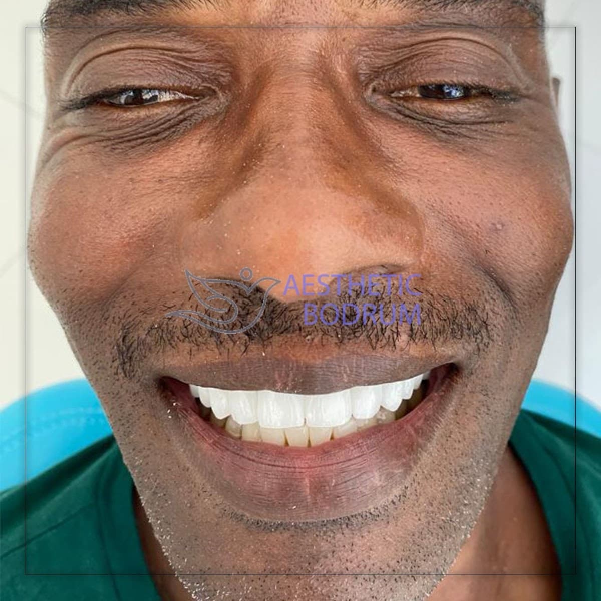 İstanbul White | Dentist in İstanbul