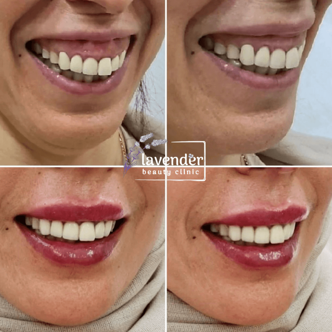 Lavender Beauty Clinic