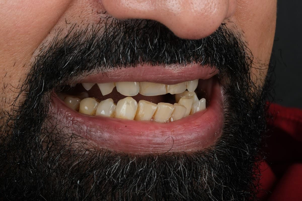 Sevil Smile Studio Istanbul