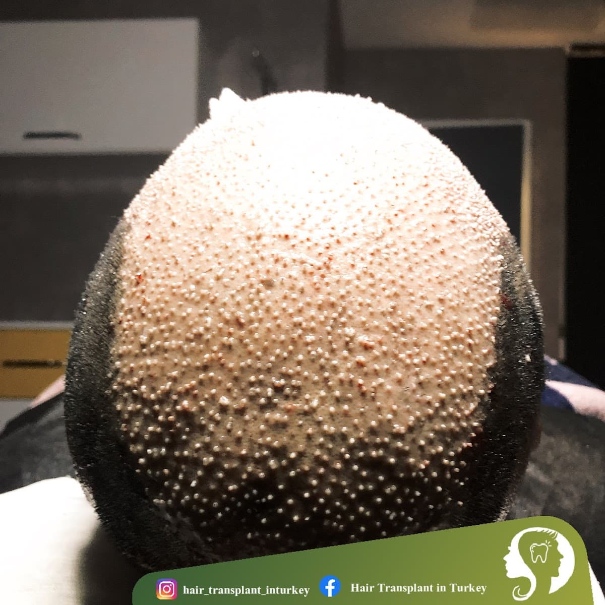 Istanbul Beauty Center