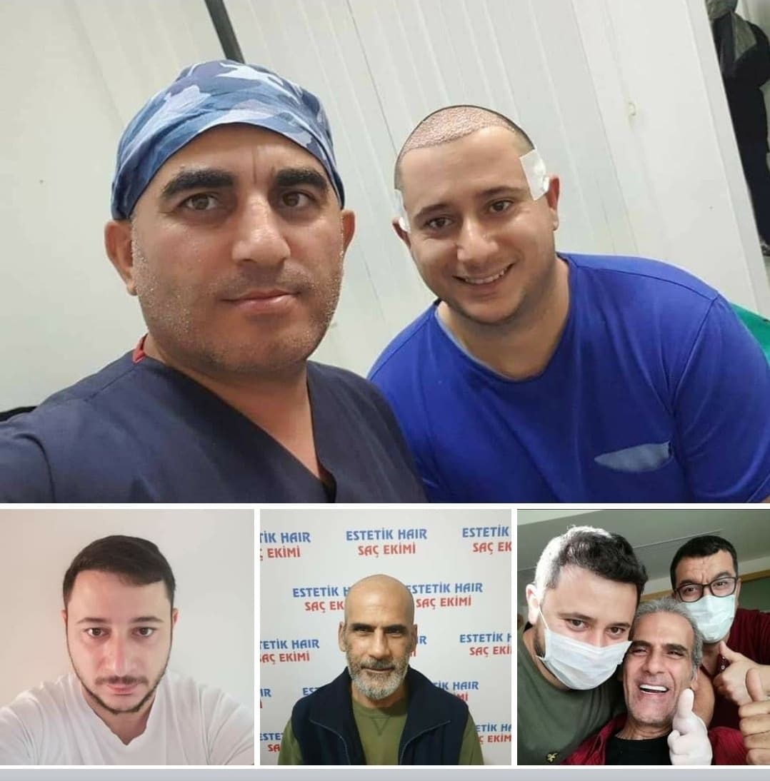 Estetik Hair / Antalya Saç Ekimi