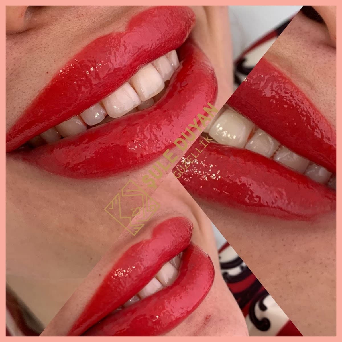 Şule Duyan Güzellik(Hydrafacial/Laser Hair Removal/Skin Care/Cosmetic Aesthetic