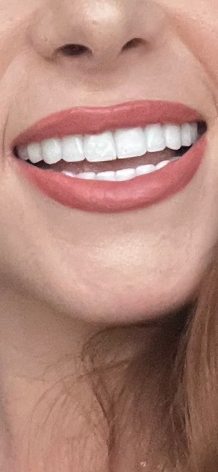 Türkiye Dental