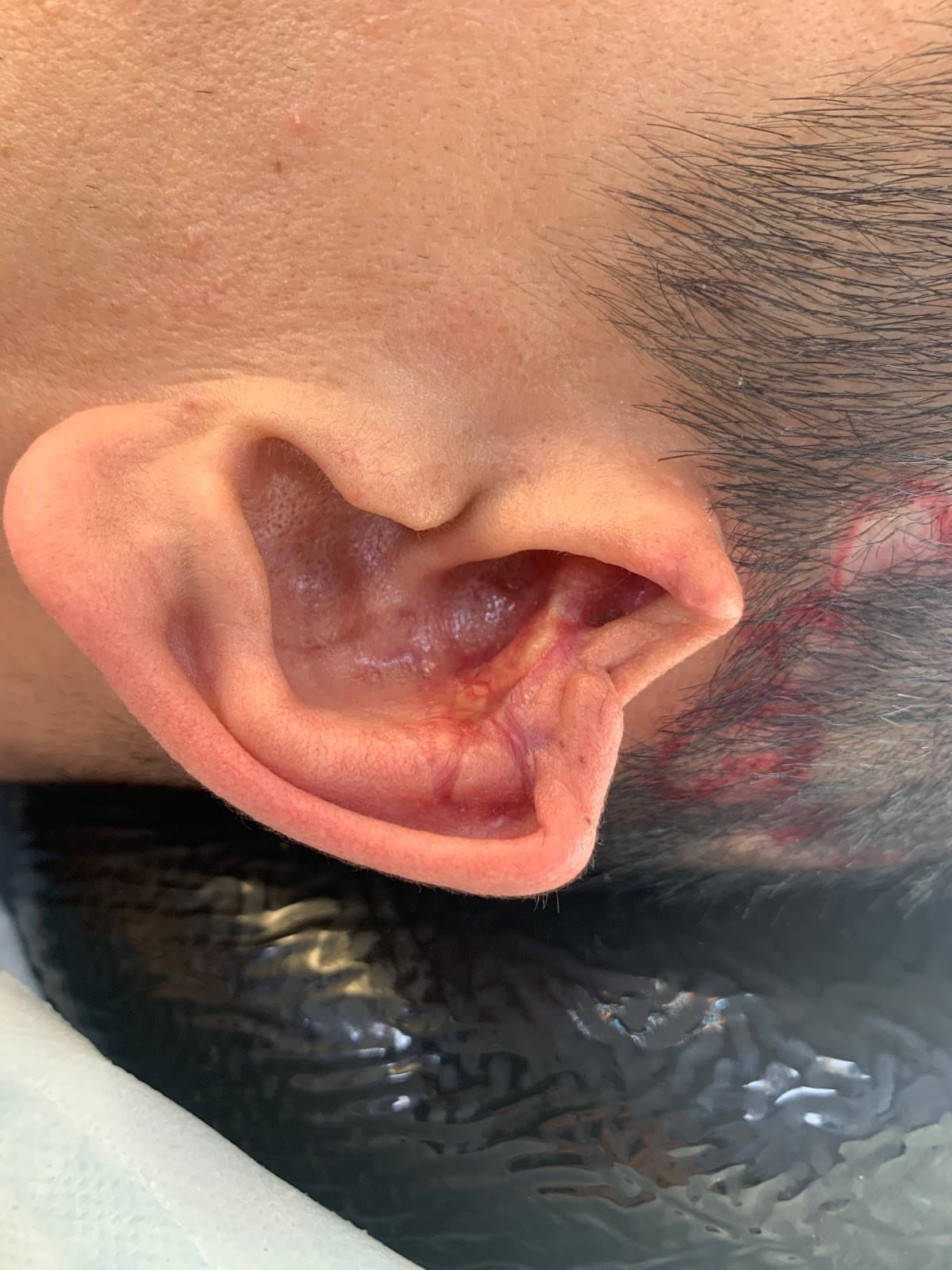 Prof Dr Selahattin Özmen, MD, FACS, FEBOPRAS