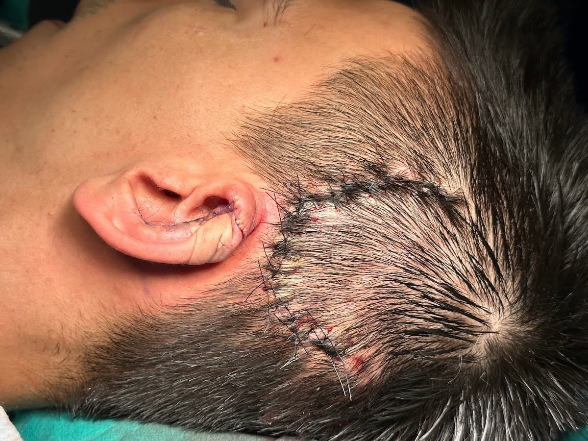 Prof Dr Selahattin Özmen, MD, FACS, FEBOPRAS