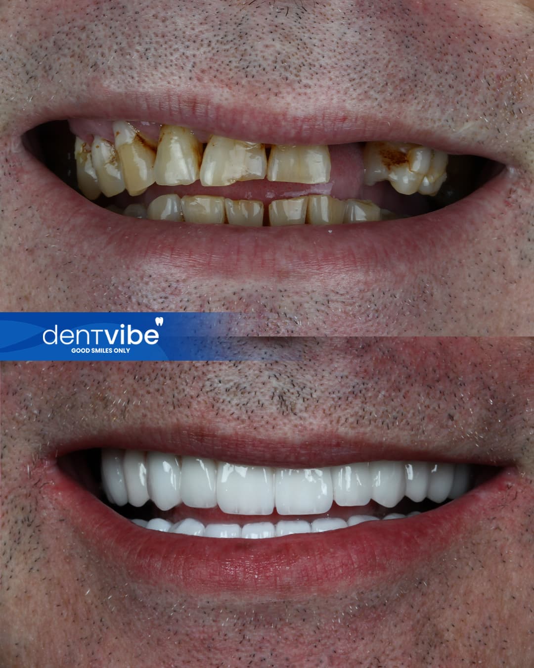 Dentvibe Dental Clinic