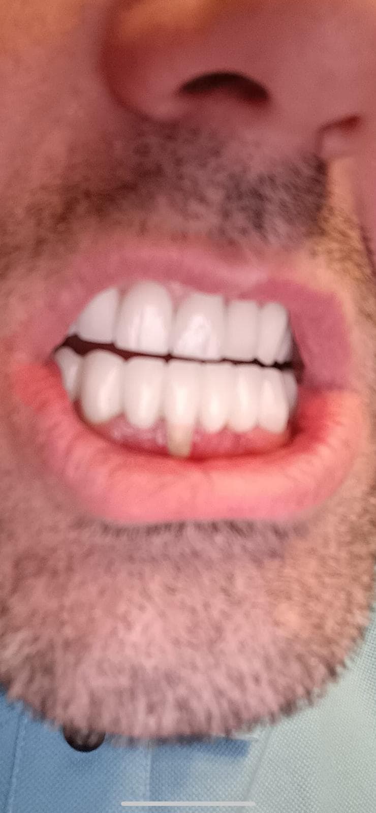 DentaFLY Dental Implant & Smile Studio