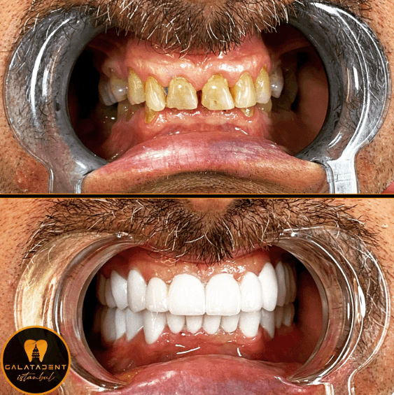 GalataDent Istanbul Diş Kliniği