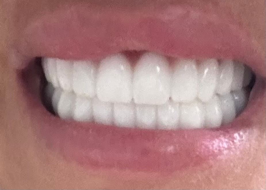 ES Clinic Turkey | Excellent Smile Clinic