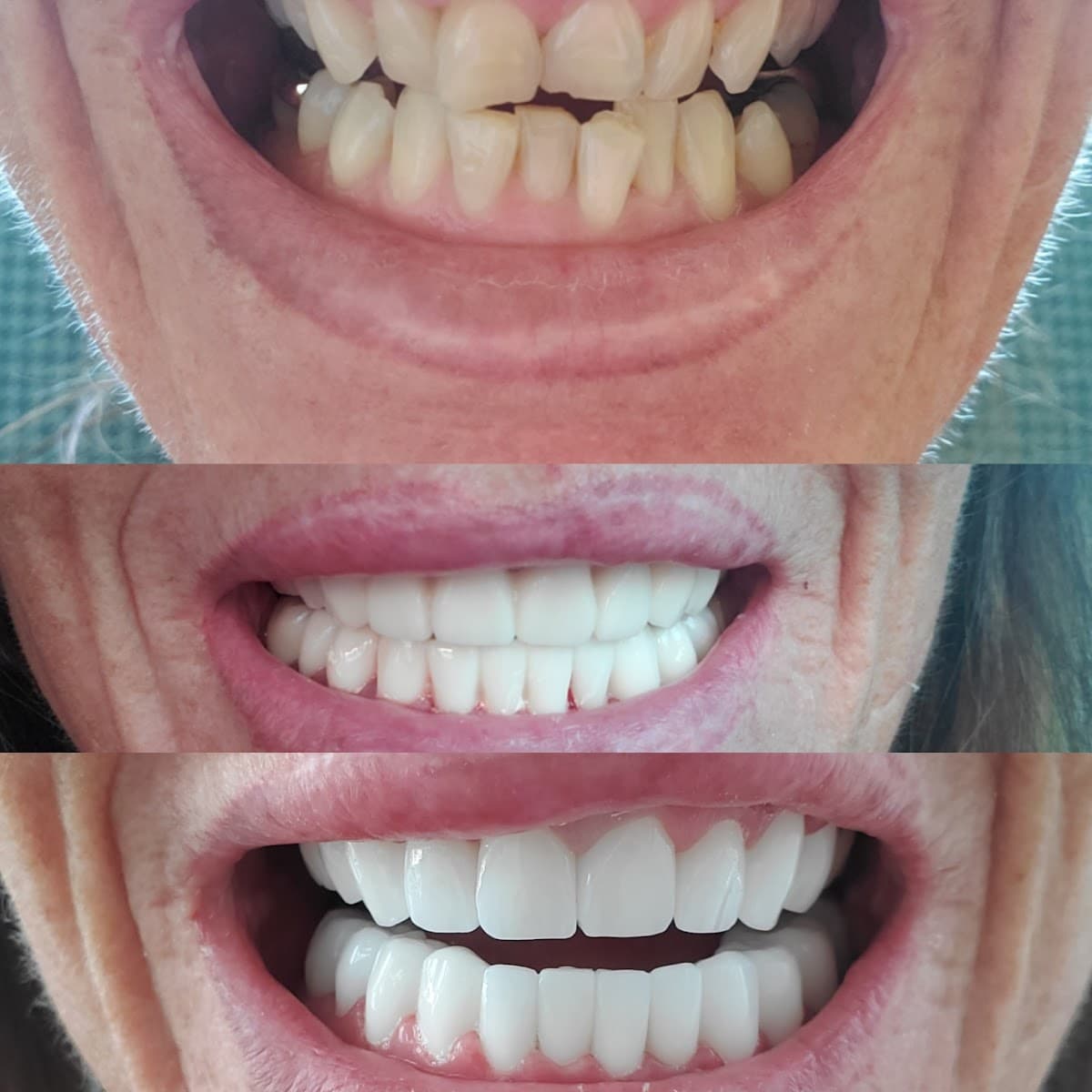 ES Clinic Turkey | Excellent Smile Clinic