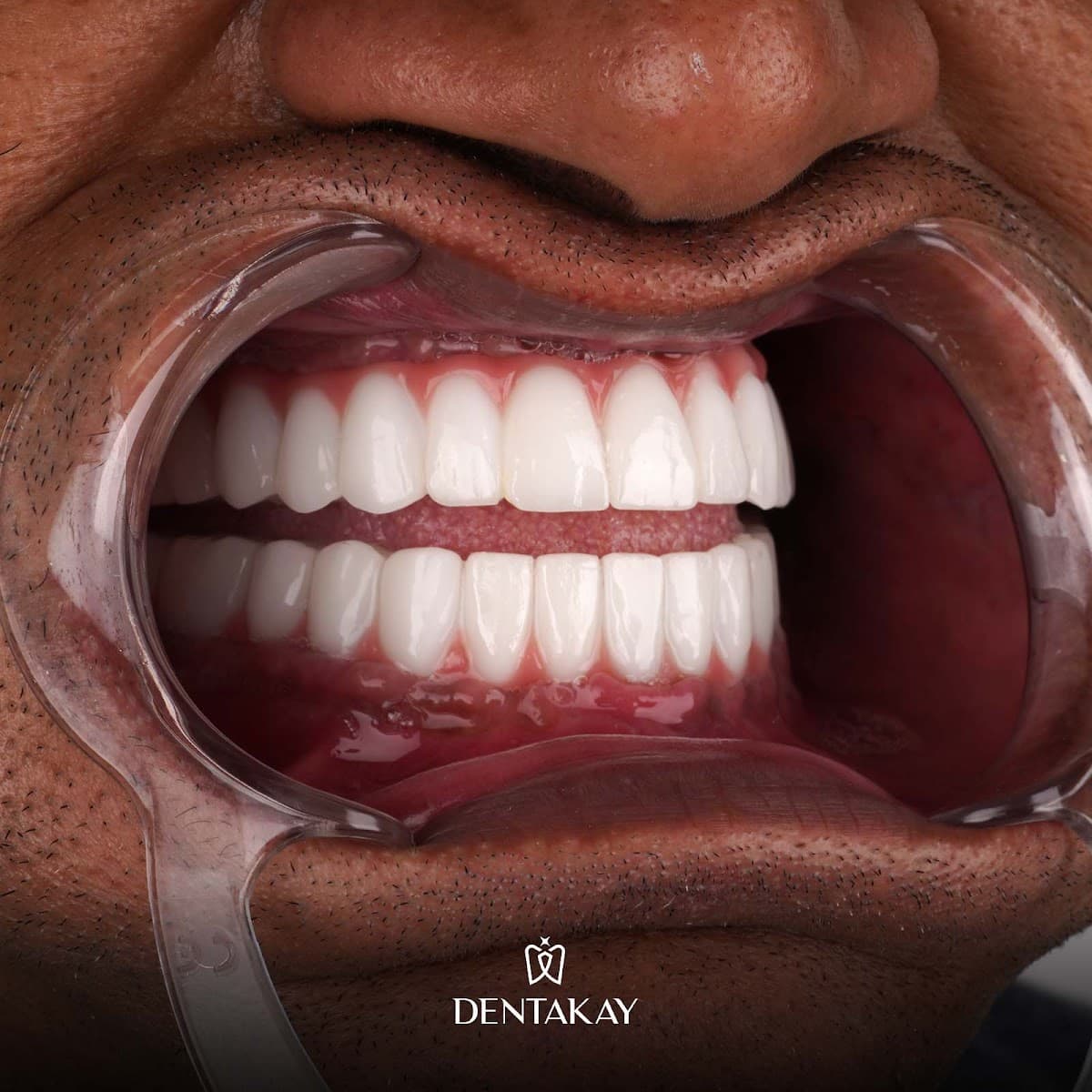 Dentakay Dental Clinic Nish İstanbul