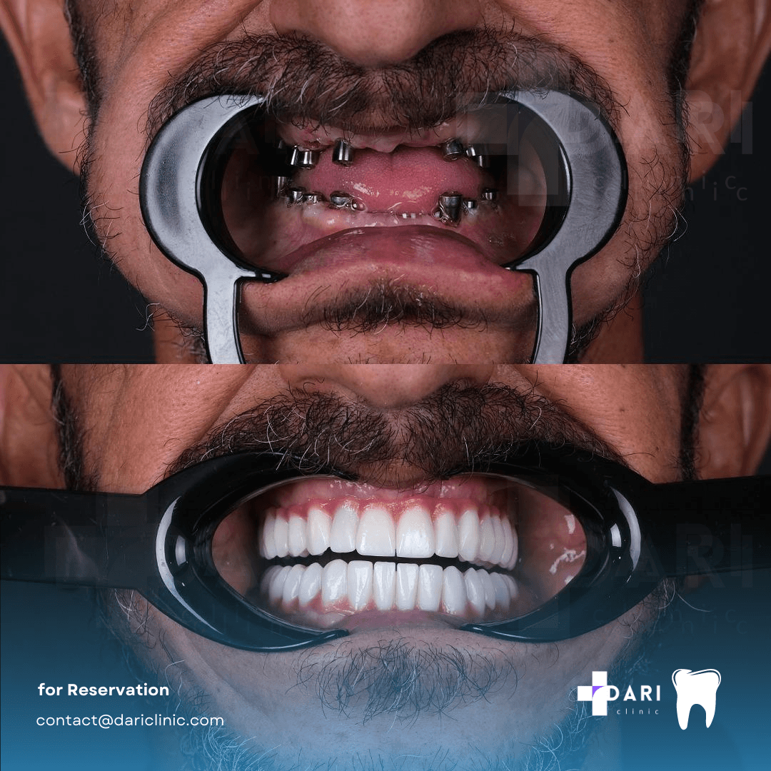 ONY Clinic - | Dental | Tummy Tuck | Hair Transplant | Aesthetic Clinic | Liposuction | Rinoplasti