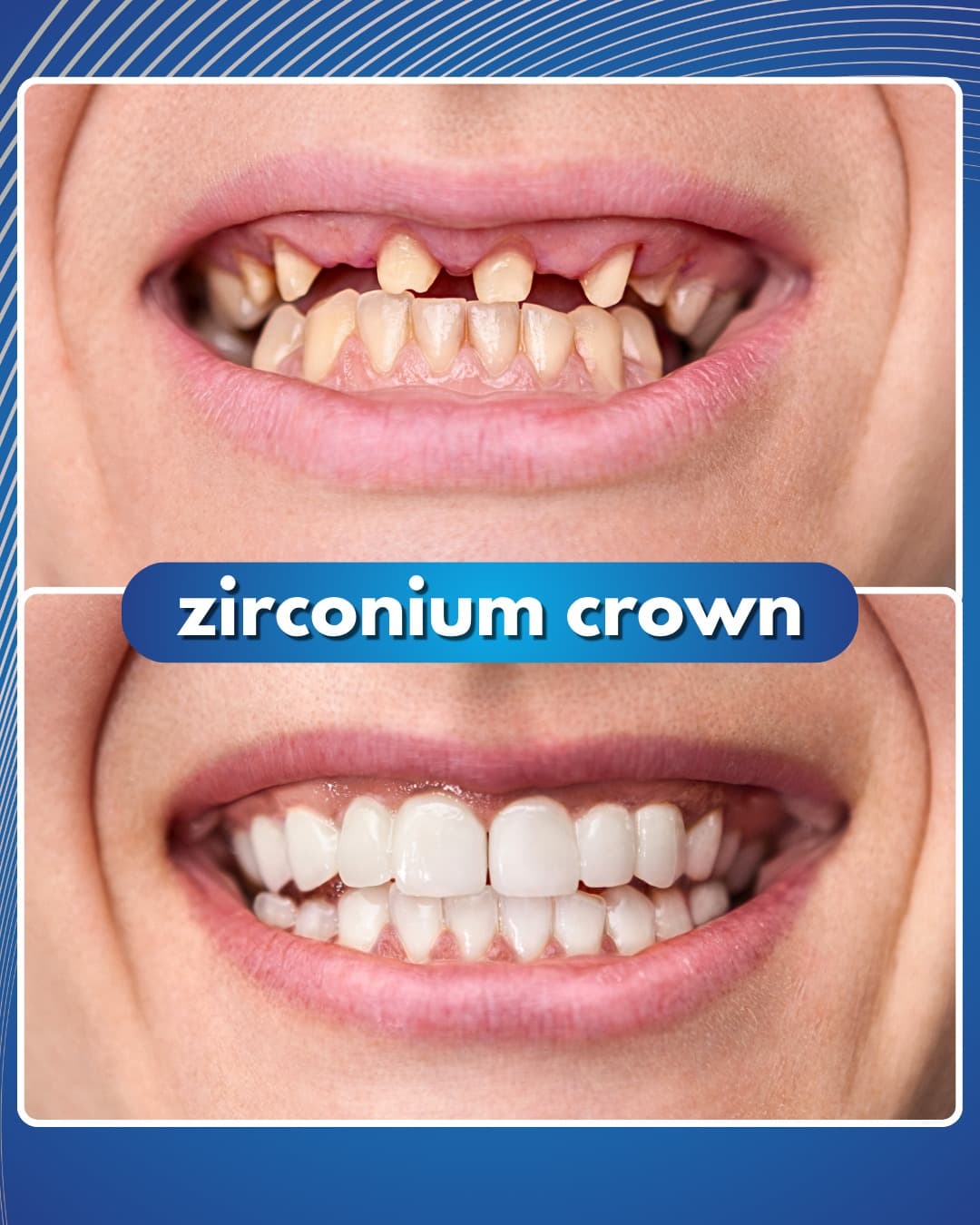 Bağcılar İmplant Dentbul Diş Kliniği