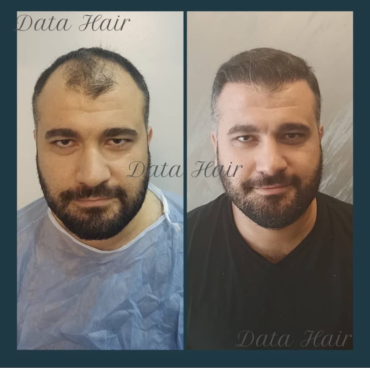 Data Hair Clinic & Eyyüp Tütüncü Saç Ekim Merkezi