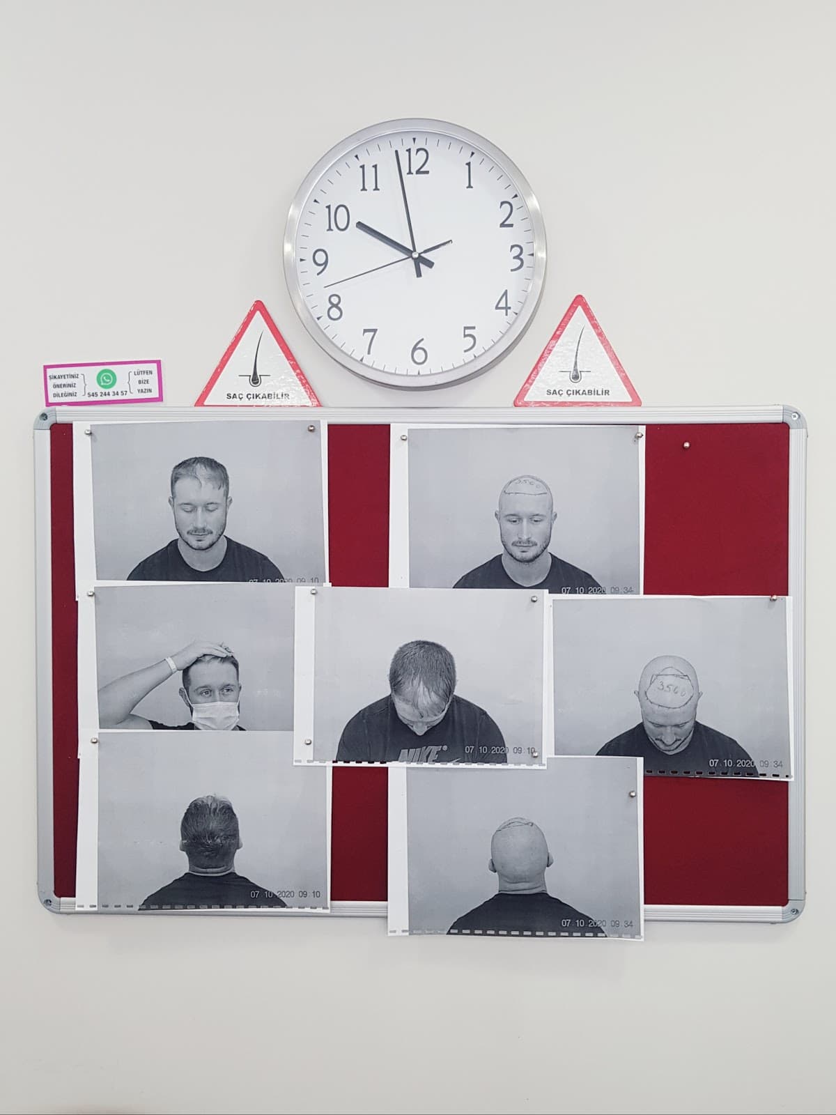 DK Klinik (Dermatology and Hair Transplant Antalya)