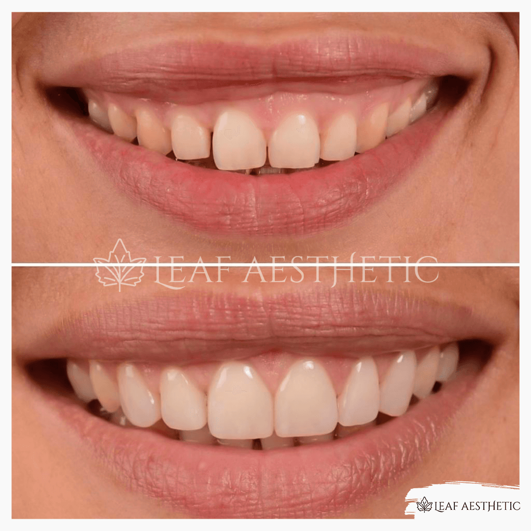 Leaf Aesthetic Clinic