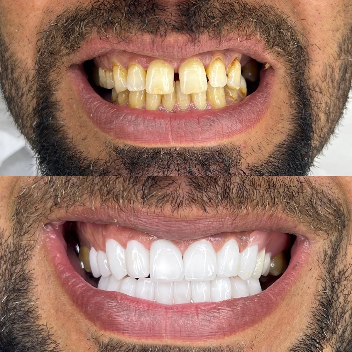 Diş hekimi .دكتور عمر عقيد Dr Omar Akeed Dental clinic