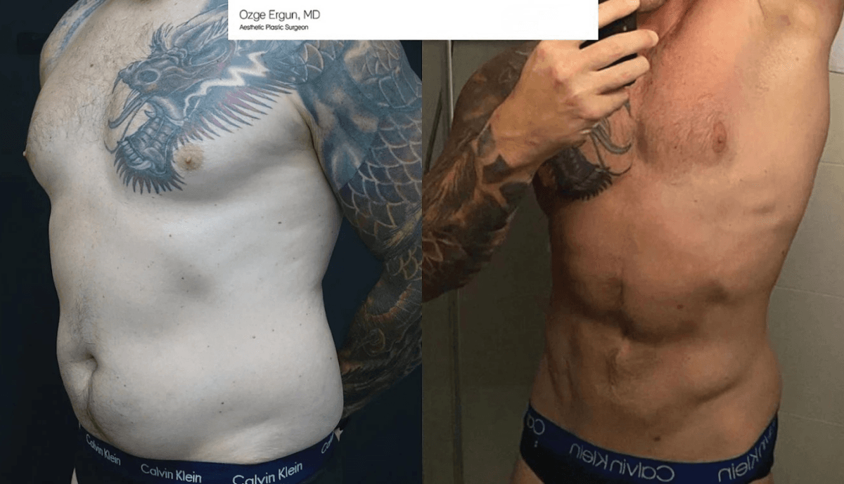 Dr. Ozge Ergun Aesthetic Surgery