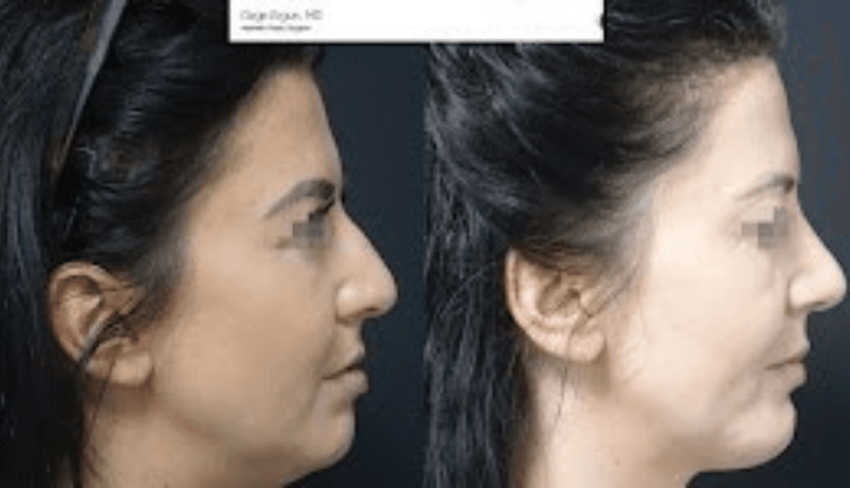 Dr. Ozge Ergun Aesthetic Surgery