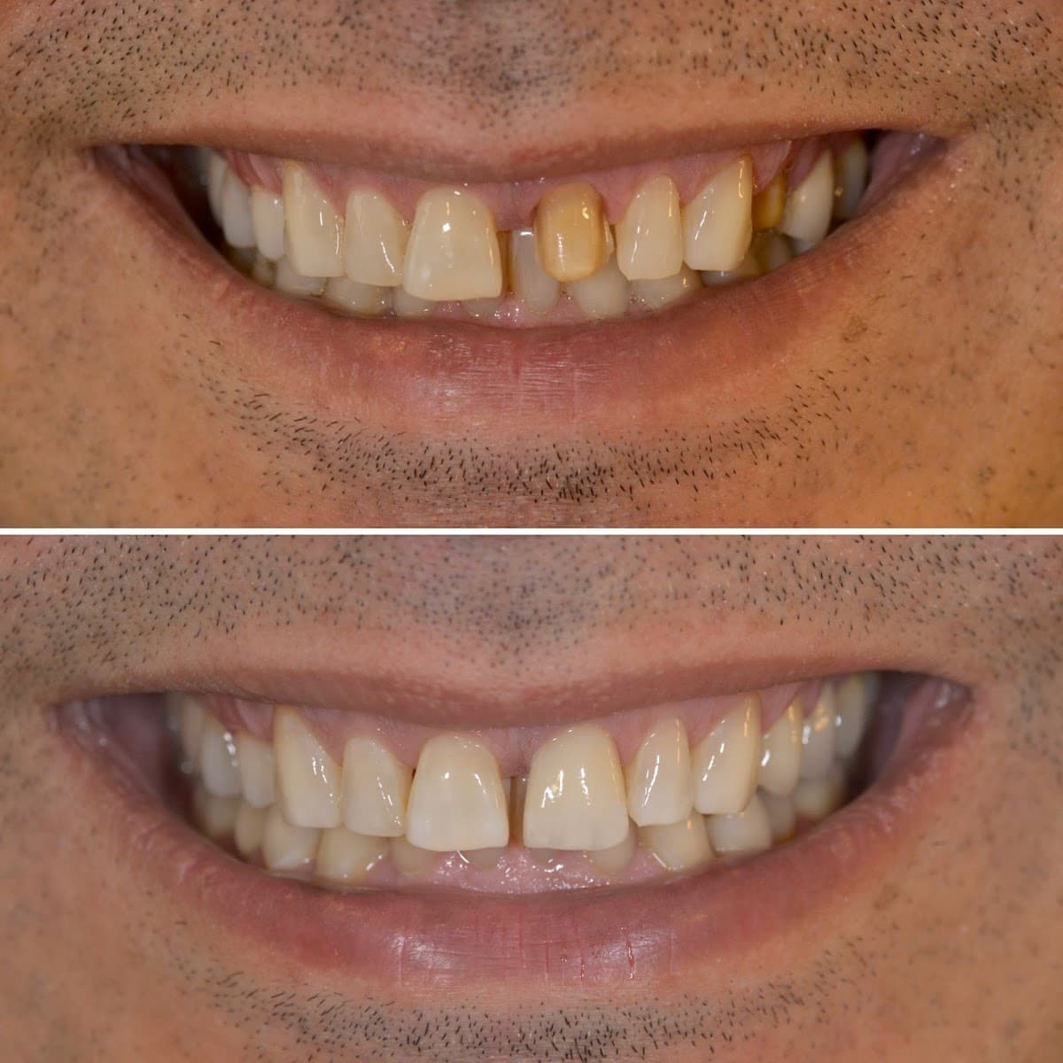 Dr. Cem Baysal | Dental Clinic Turkey | 33 Years Of Experience