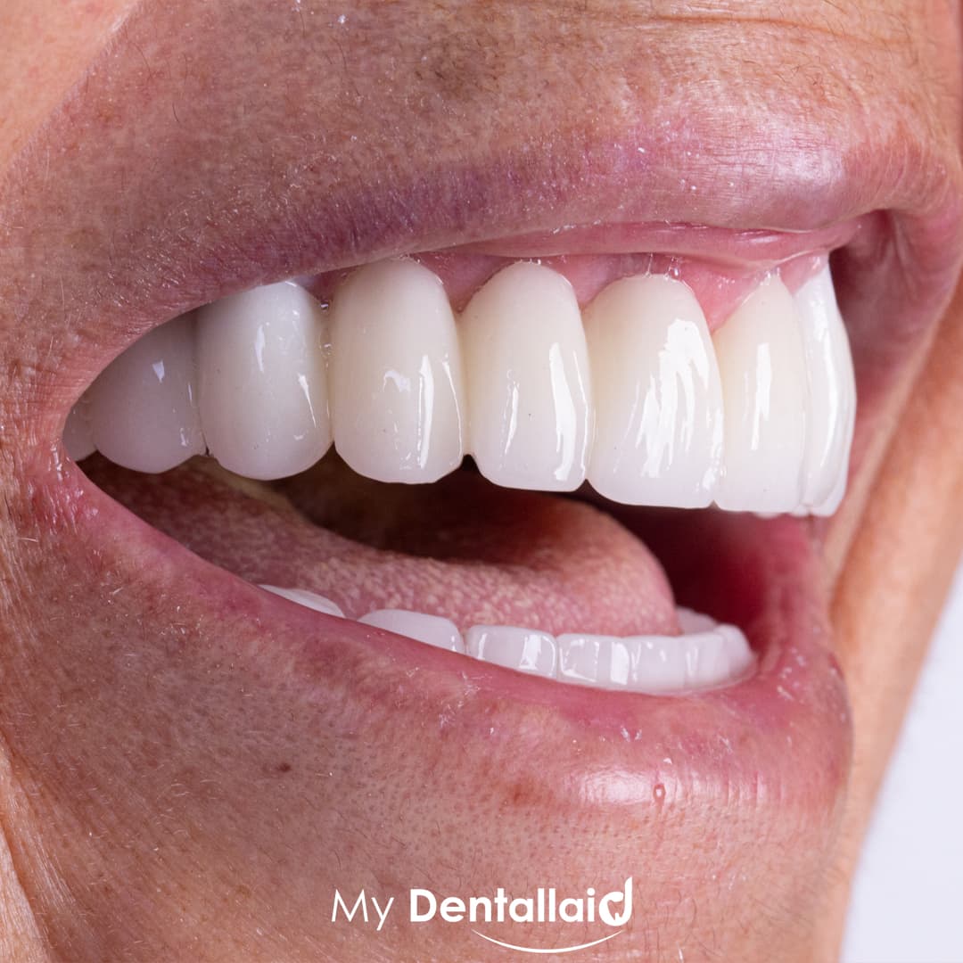 Dental Clinic in İstanbul - Aesthetic Teeth - Teeth Whitening and Veneer - Smile Design - Inlay Onlay