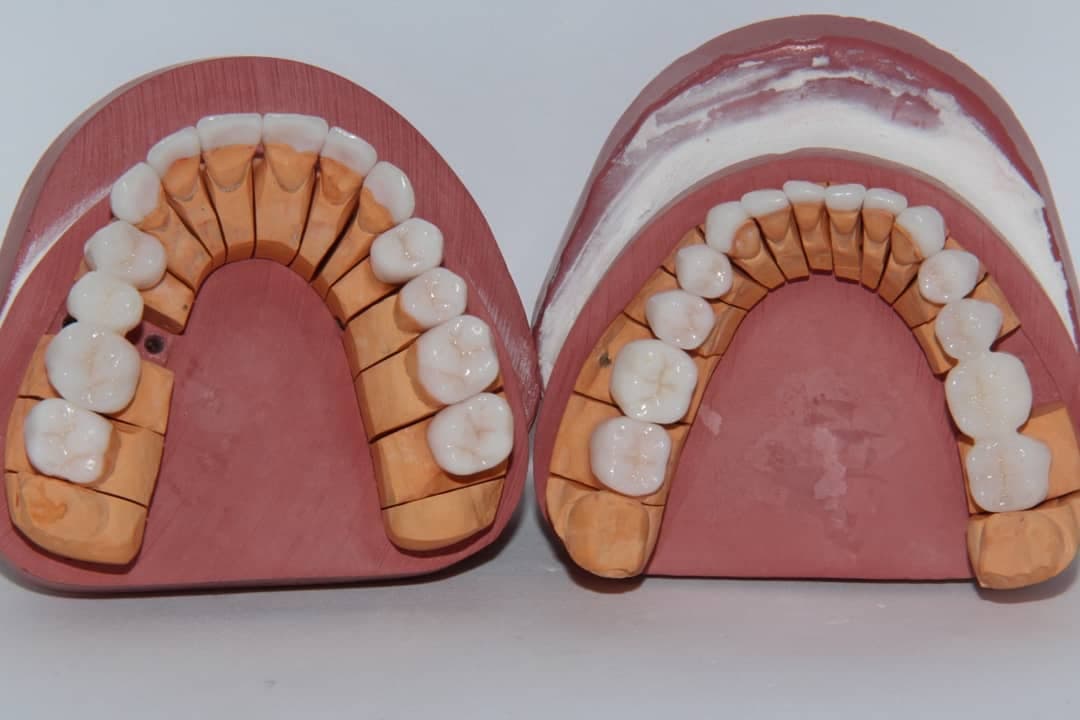 Dental Aesthetic Turkey