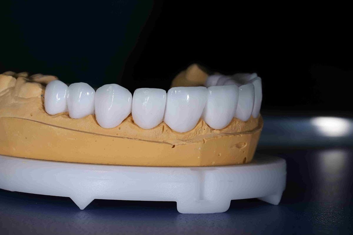 Dental Aesthetic Turkey