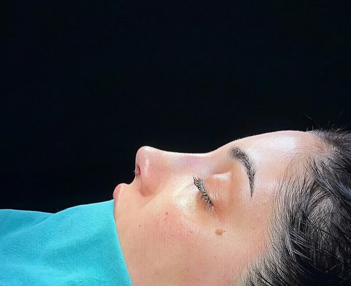 Op. Dr. Deniz Dilek , Burun Estetiği