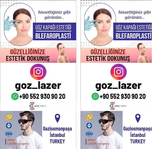 Http.gozlazerameliyati