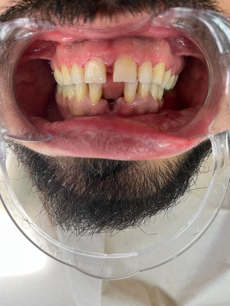 Özel Dent 35 Ağız ve Diş Sağlığı Polikliniği Alsancak