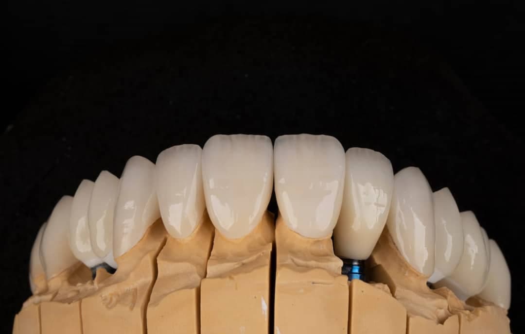 Ankara Gülüş Tasarımı