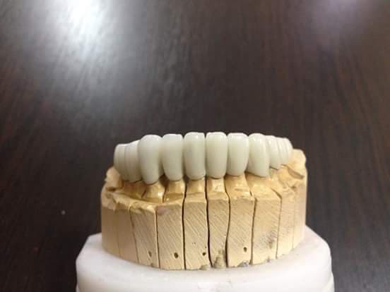 Ankara Gülüş Tasarımı