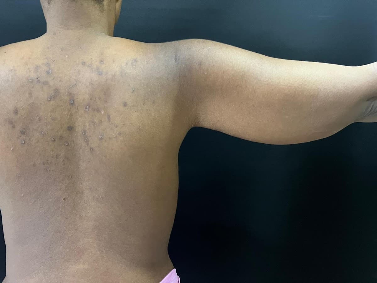 Plastic Surgeon in Istanbul, Turkey | Dr. Erman Ak