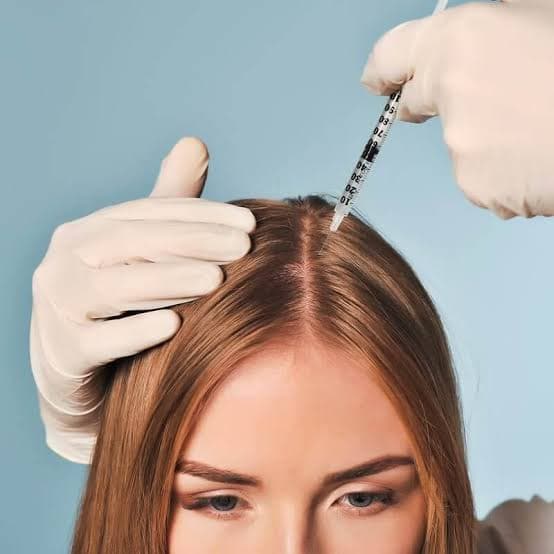 İstanbul Saç Ekimi