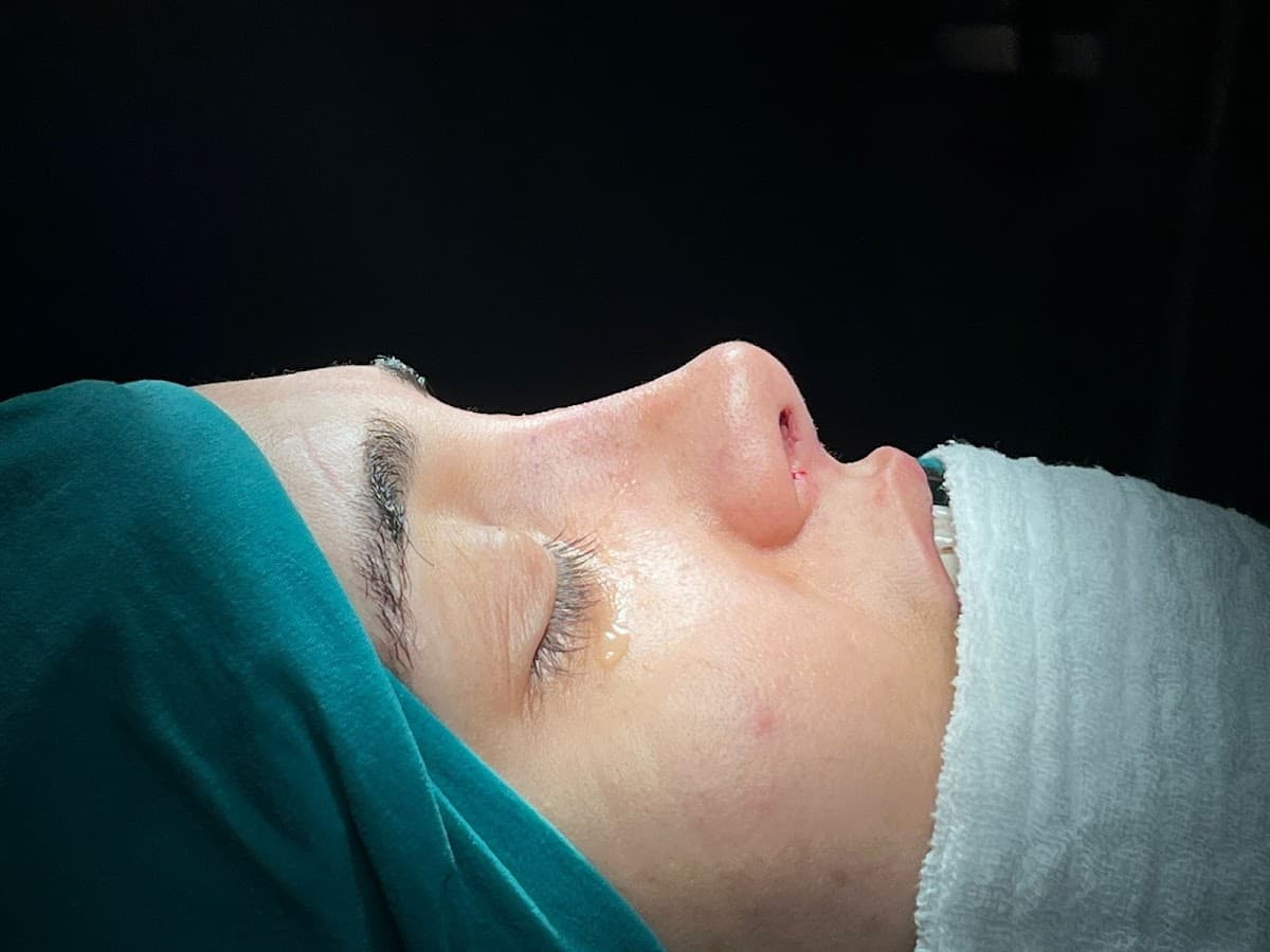 Op. Dr. Yahya Demirdelen - KBB Uzmanı - Burun Estetiği İzmir