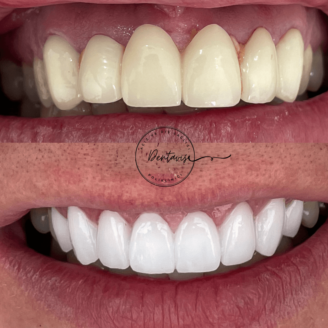 Dentavis Ağız ve Diş Sağlığı Polikliniği