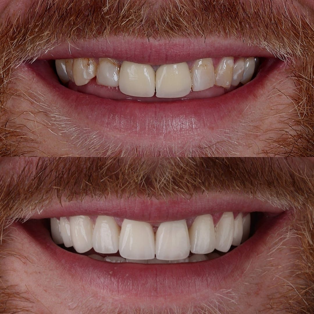 Dental Excellence Turkey