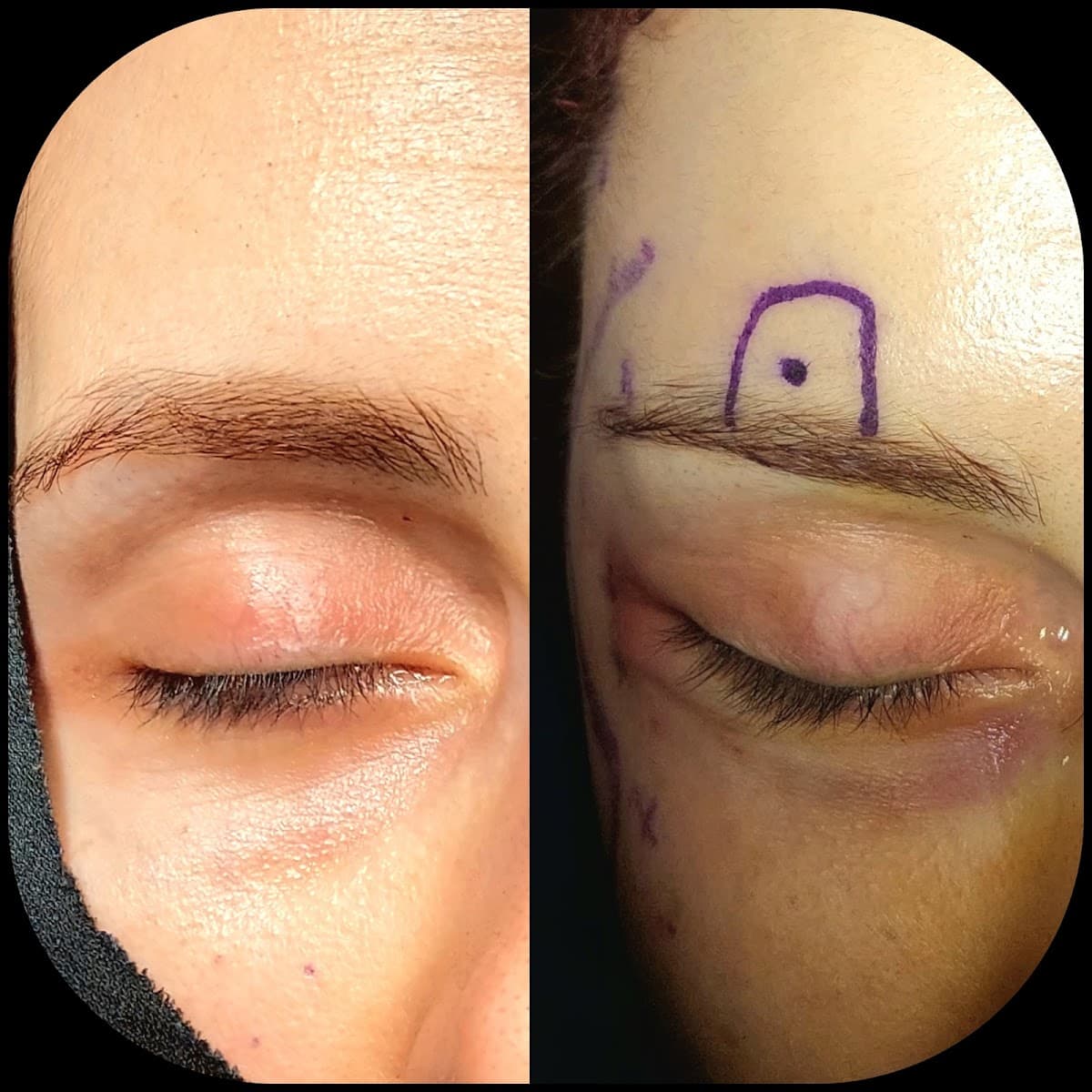 Doç.Dr.Alper Ural Plastik Rekonstrüktif ve Estetik Cerrahi